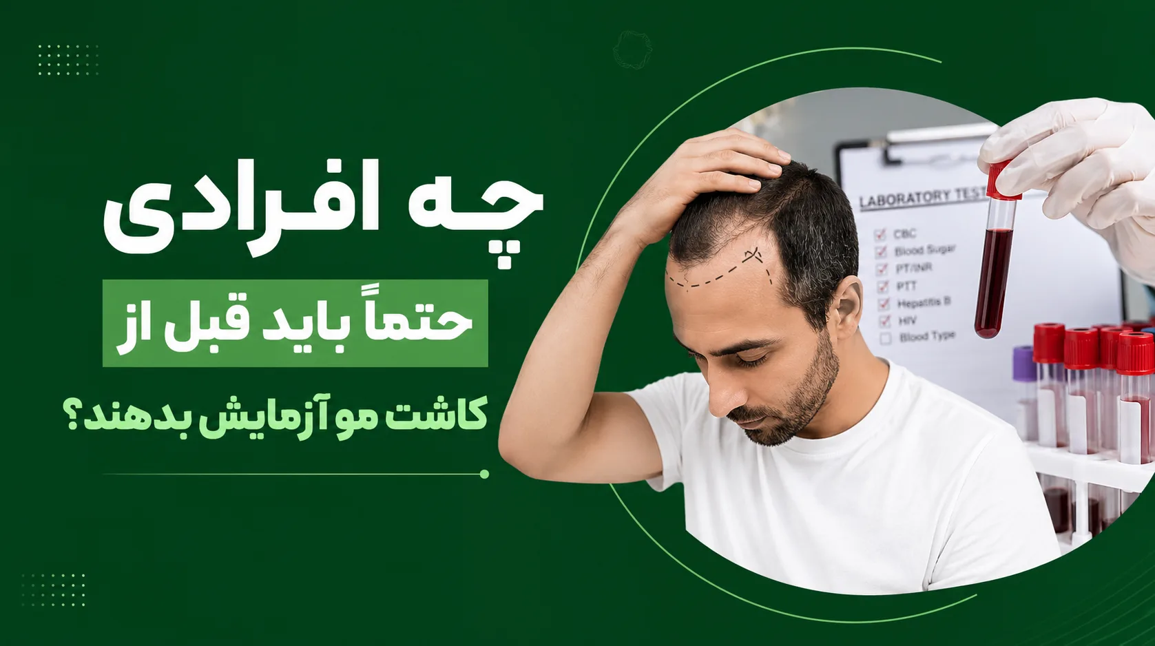چه افرادی حتماً باید قبل از کاشت مو آزمایش بدهند؟